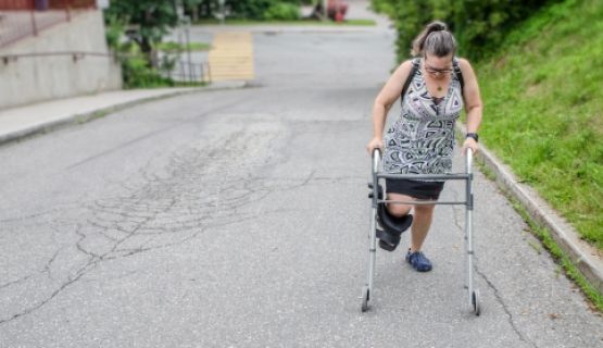 A woman with a leg cast and walker walks up a road.